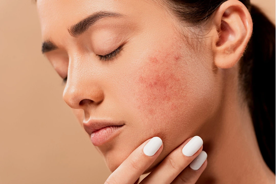 Burning Sensation in the Skin: Possible Causes and Remedies